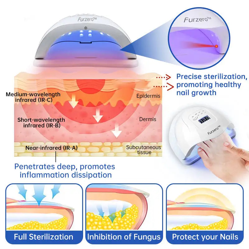 Fungus Laser Therapy Device